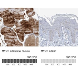 Myotilin Antibody, Novus Biologicals:Antibodies:Primary Antibodies